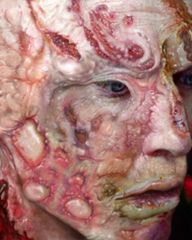 The new Freddy Krueger (portrayed by Jackie Earle Haley) features realistic burns, compared to Robert Englund's famous portrayal of Freddy.