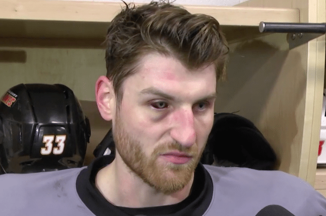 Flames’ Nakladal ‘dodged a big bullet’ by avoiding serious eye injury following high stick