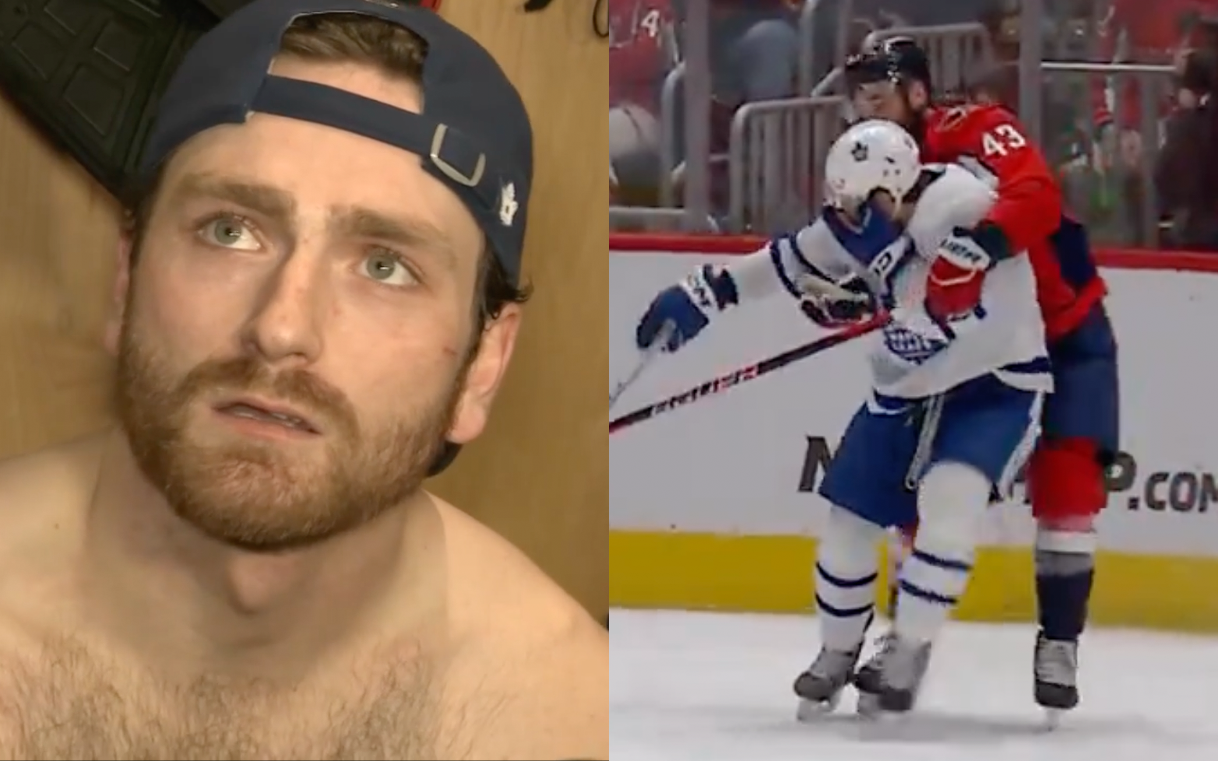 Screencap: Leafs/Sportsnet - Leafs' Noah Gregor Comments On Tom Wilson's High Stick & Pending Hearing, Suffered Broken Teeth From Hit