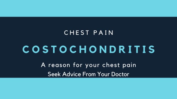 living-with-costochondritis