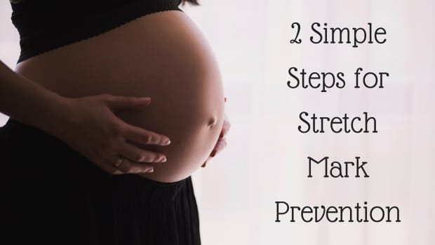 prevent-stretch-marks-during-pregnancy