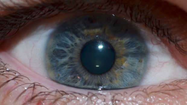 anatomy-of-the-eye-series-the-tear-film-lids-and-adnexa