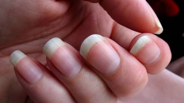 why-some-people-bite-their-nails