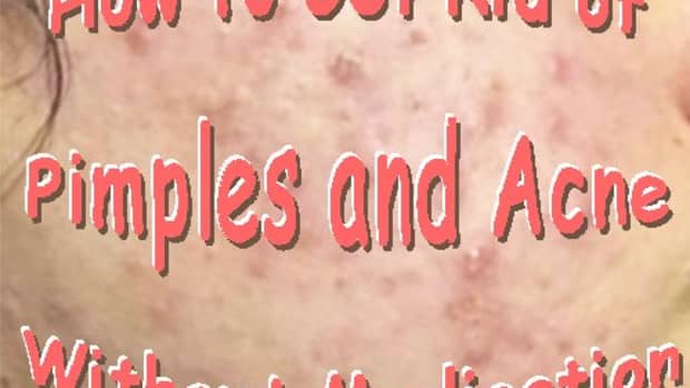 how-to-get-rid-of-skin-problems-hair-raising-discovery-for-pimples-and-acne