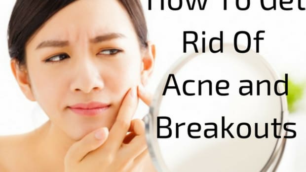 how-to-get-rid-of-acne-and-breakouts