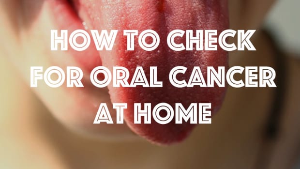 how-to-check-yourself-for-oral-cancer