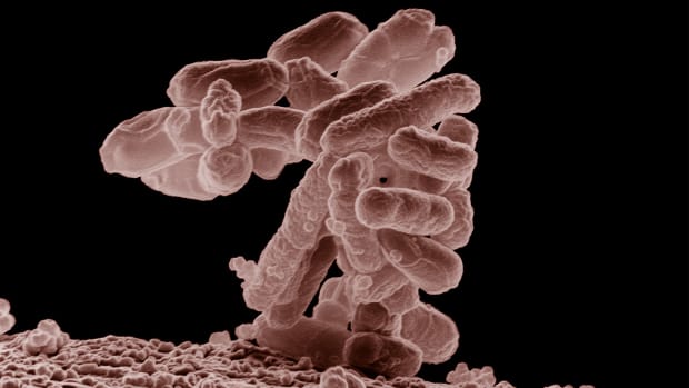 escherichia-or-e-coli-intestinal-flora-and-bacterial-infection