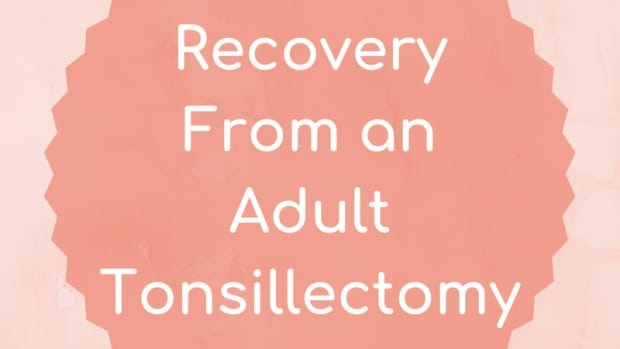 tonsillectomy-for-adults