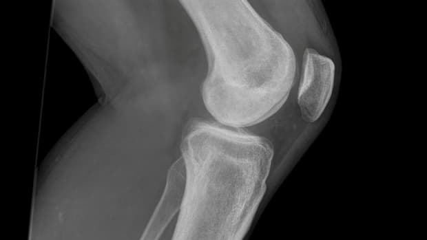 knee-anatomy-anatomy-of-the-knee-joint