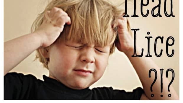 how-to-get-rid-of-head-lice-permanently