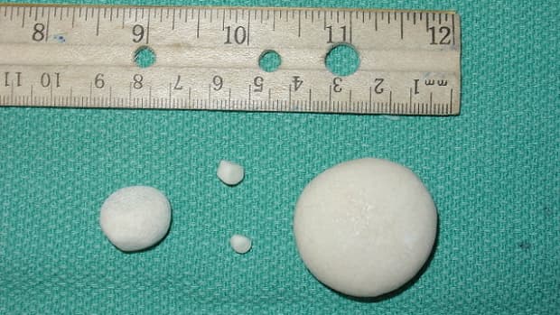oxalate-stones-in-dogs-what-happens-when-dogs-have-bladder-stones