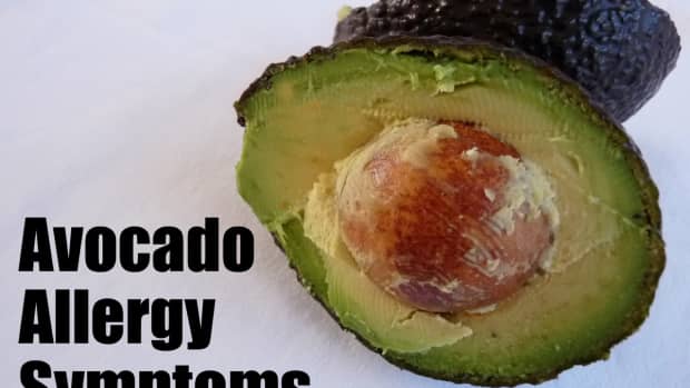 avocado-allergy-symptoms