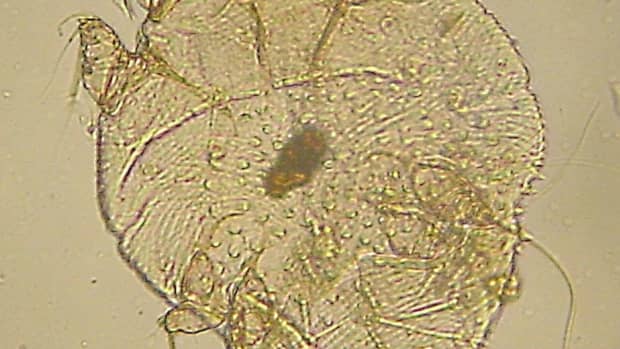 skin-mites-rosacea-and-blepharitis