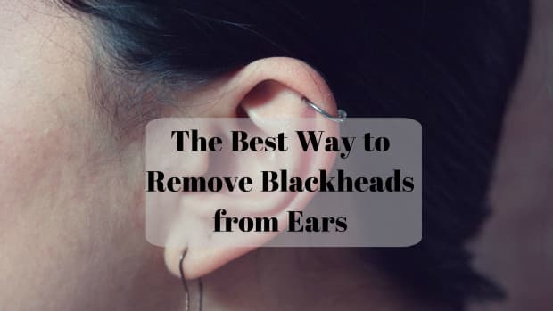 how-to-get-rid-of-blackheads-in-ears