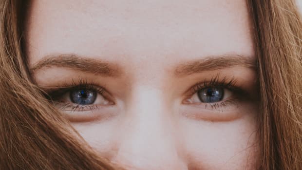 remove-dark-circles-under-eyes-permanently
