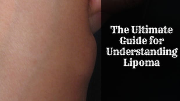 what-you-should-know-about-lipoma