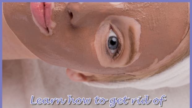 how-to-get-rid-of-whiteheads-and-clogged-pores