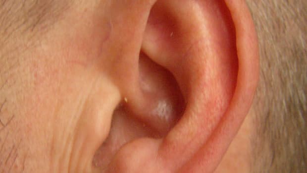 how-to-remove-ear-wax-safely-at-home