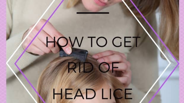 how-to-get-rid-of-head-lice-1