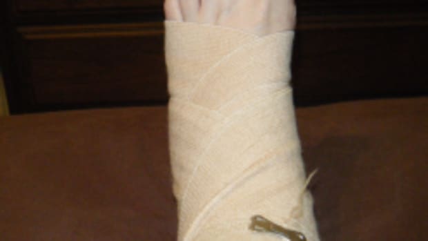 broken-ankle4