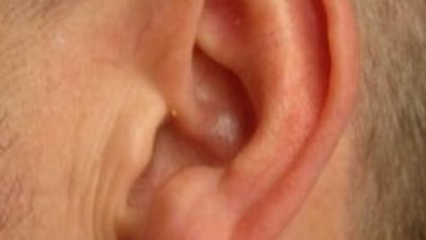 ear-abscess