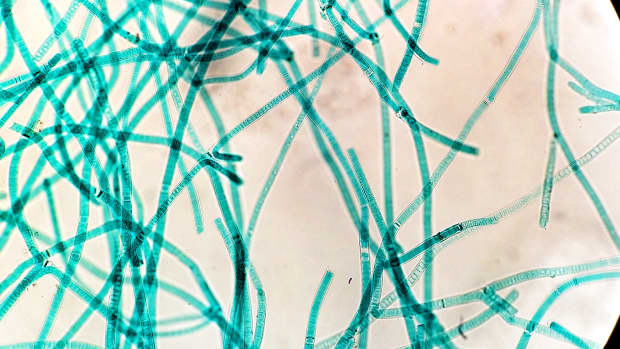what-are-cyanobacteria-and-how-are-they-similar-or-different-from-true-plants