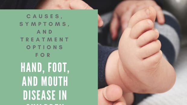 children-and-hand-foot-and-mouth-disease