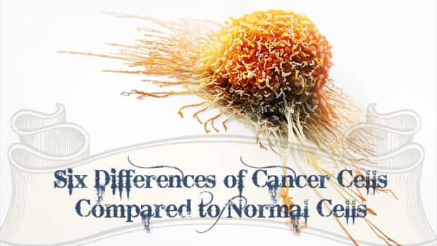 six-differences-of-cancer-cells-compared-to-normal-cells