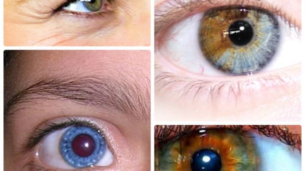 heterochromia-iridum-people-with-two-different-colored-eyes