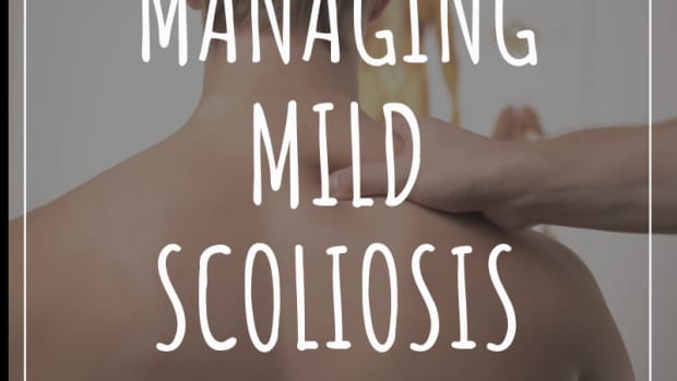 3-ways-to-treat-mild-scoliosis