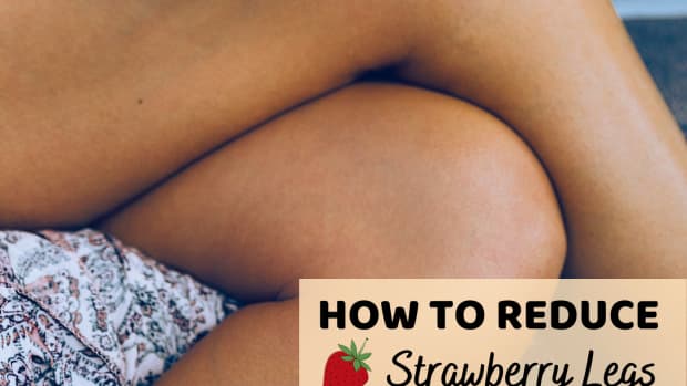 beautybenefits-how-to-remove-strawberry-legs