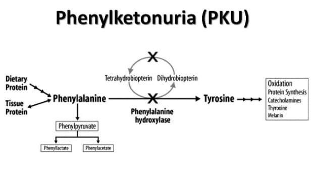 genetic-disorders-phenylketonuria