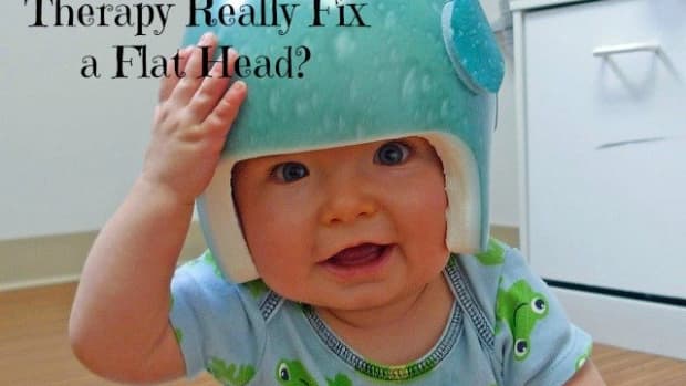 cranial-helmet-therapy-for-babies-does-it-actually-fix-a-flat-head