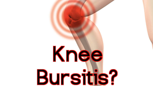 bursitis-knee-pain-braces-and-pads