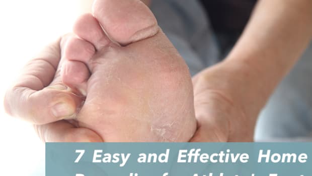 home-remedies-for-athletes-foot-uk