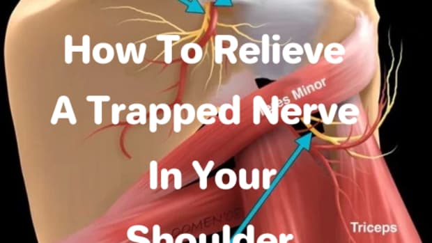 how-to-relieve-a-trapped-nerve-in-your-shoulder