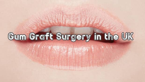 gum-graft-surgery-and-cost-uk