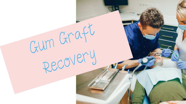 how-long-does-it-take-to-heal-from-gum-graft-surgery