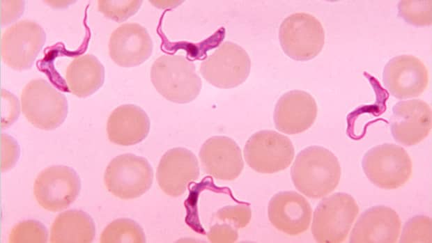 immune-system-evasion-by-the-protozoan-parasite-trypanosoma-brucei