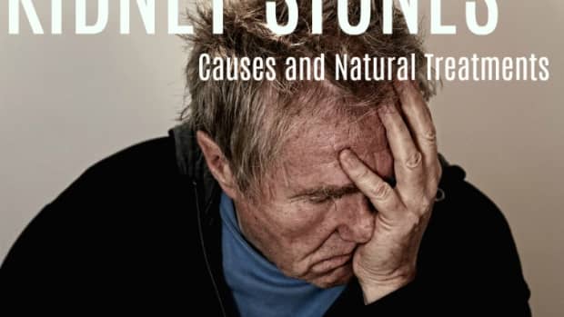 what-causes-kidney-stones-and-how-to-avoid-them