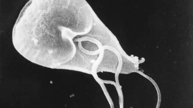 giardia-in-the-intestine-an-interesting-parasite