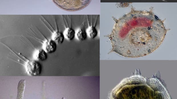 4-main-groups-of-protozoa