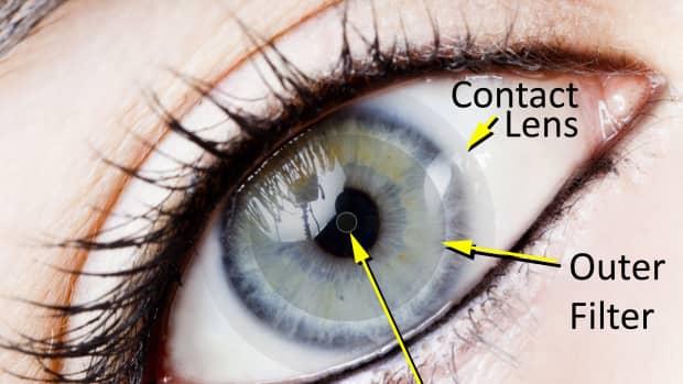 do-contact-lenses-cause-pressure-increase-in-eyes
