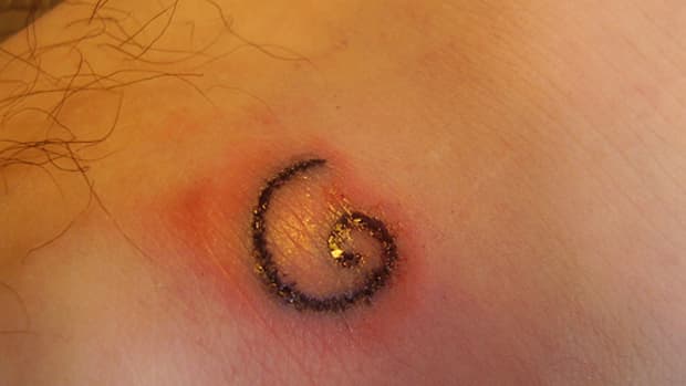 HOW TO TREAT AN INFECTED TATTOO – ink-nurse.uk