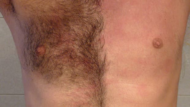 manscaping-hair-removal-for-men
