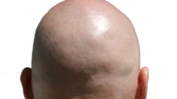7-reasons-being-a-bald-guy-rocks