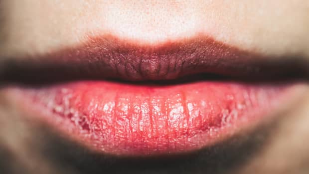 10-secrets-to-getting-rid-of-dry-skin-on-lips