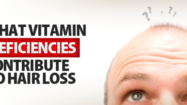 16-vitamin-deficiencies-that-lead-to-hair-loss