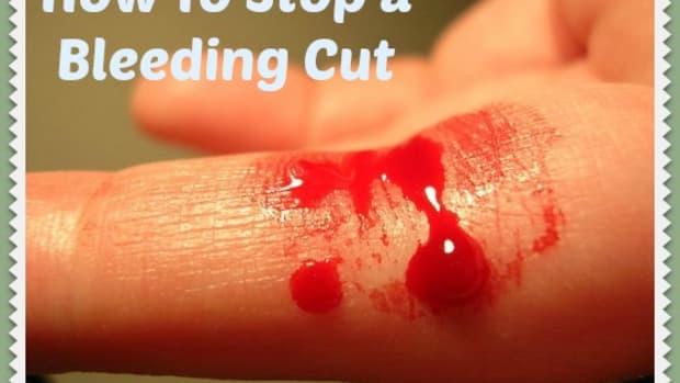 how-to-stop-a-bleeding-cut