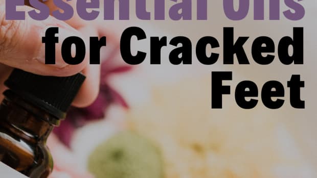treating-cracked-heels-and-fissures-with-essential-oils